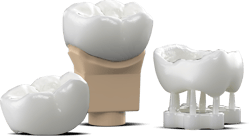 Crowns-onsupport-offsupport-onDie-2 Crowns-onsupport-offsupport-onDie-2
